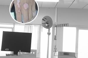 酪氨酸酶檢查要多少錢做一次